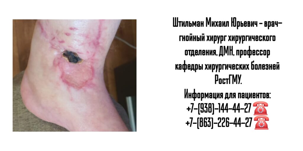 Штильман Михаил Юрьевич- профессор- гнойный хирург Ростов