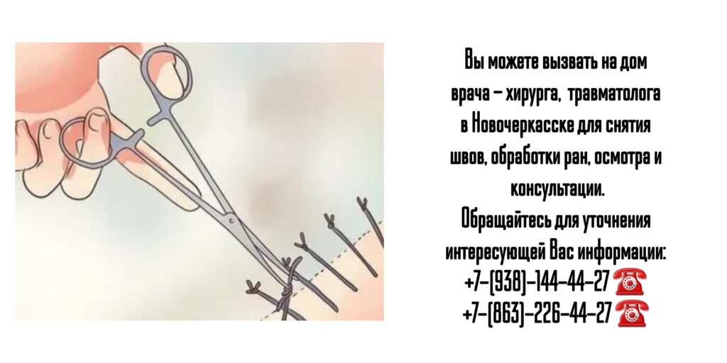 Снять швы на дому после операции в Новочеркасске