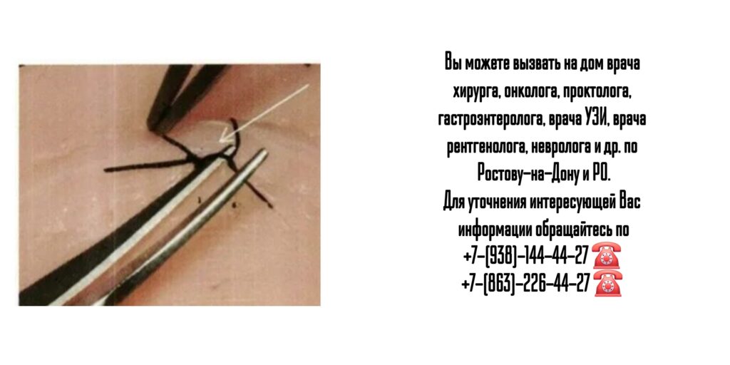 Хирург на дом - вызов врача на дом Ростов-на-Дону