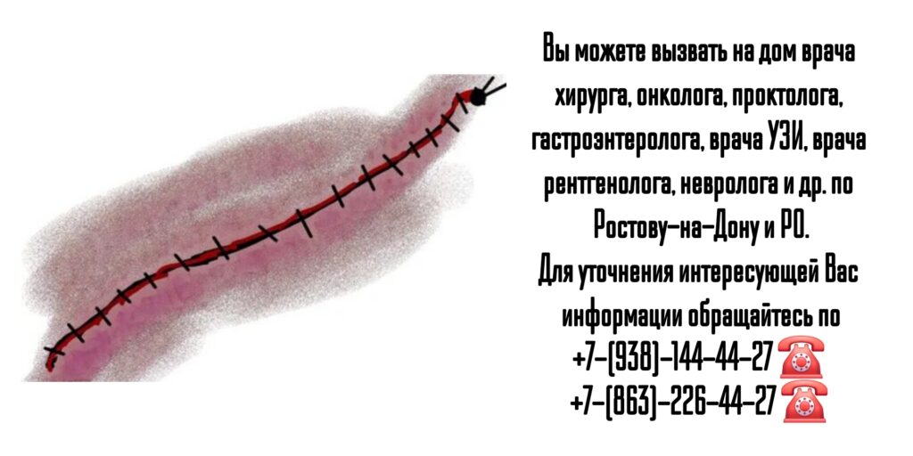 Хирург на дом - вызов врача на дом Ростов-на-Дону