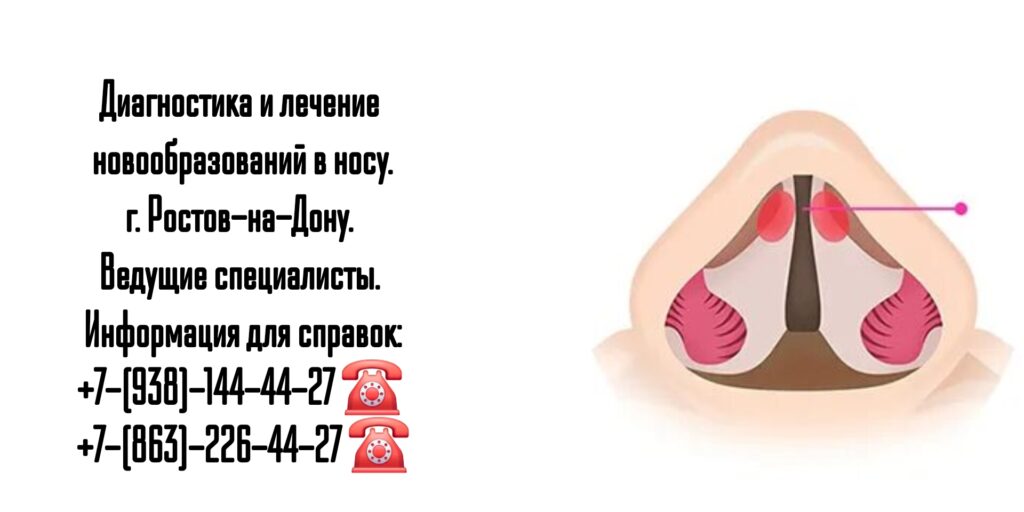 Исламова Елена Файзулаевна - Новообразование перегородки носа - биопсия Ростов-на-Дону 