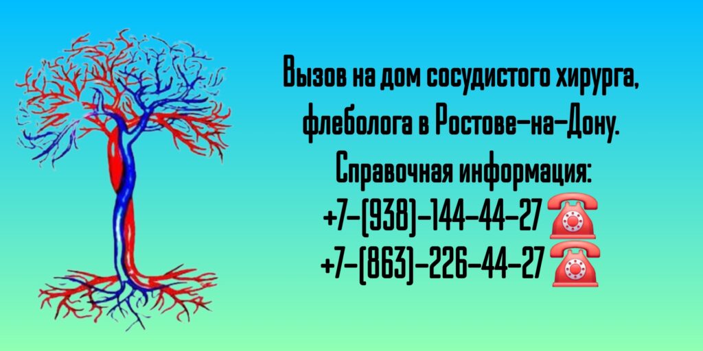 Вызов сосудистого хирурга на дом в Ростове-на-Дону