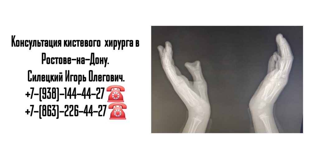 Силецкий Игорь Олегович- кистевой хирург в Ростове-на-Дону 