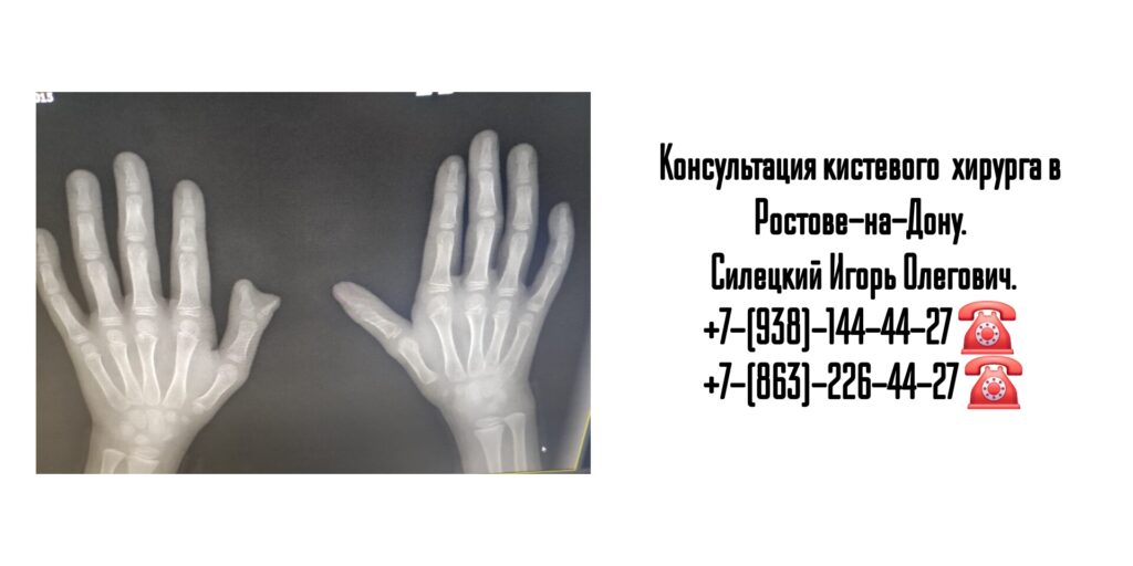 Силецкий Игорь Олегович- кистевой хирург в Ростове-на-Дону 