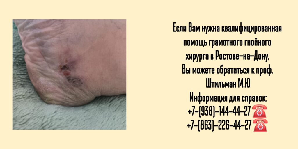 Ведущий гнойный хирург в Ростове-на-Дону  - Штильман Михаил Юрьевич 