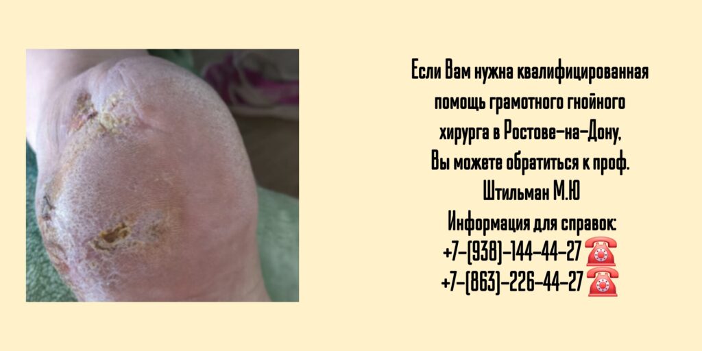 Ведущий гнойный хирург в Ростове-на-Дону  - Штильман Михаил Юрьевич 