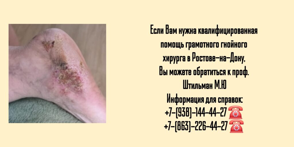 Ведущий гнойный хирург в Ростове-на-Дону  - Штильман Михаил Юрьевич 