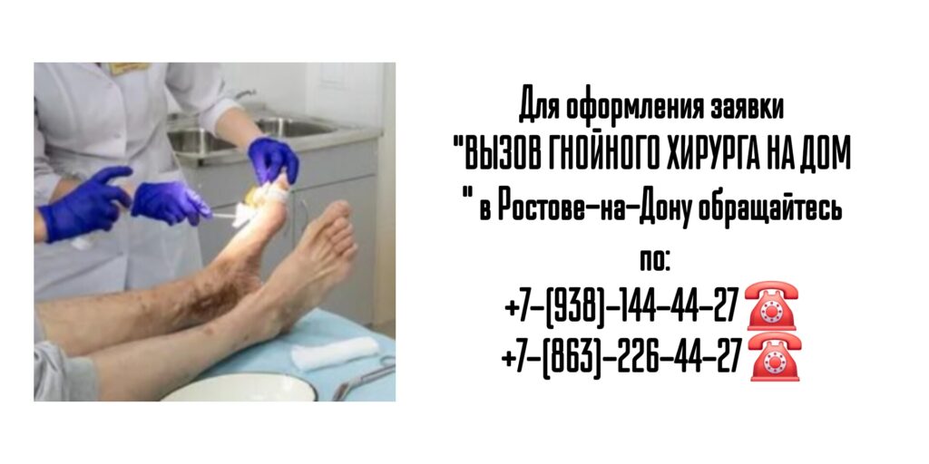 Вызов на дом гнойного хирурга- Ростов-на-Дону 