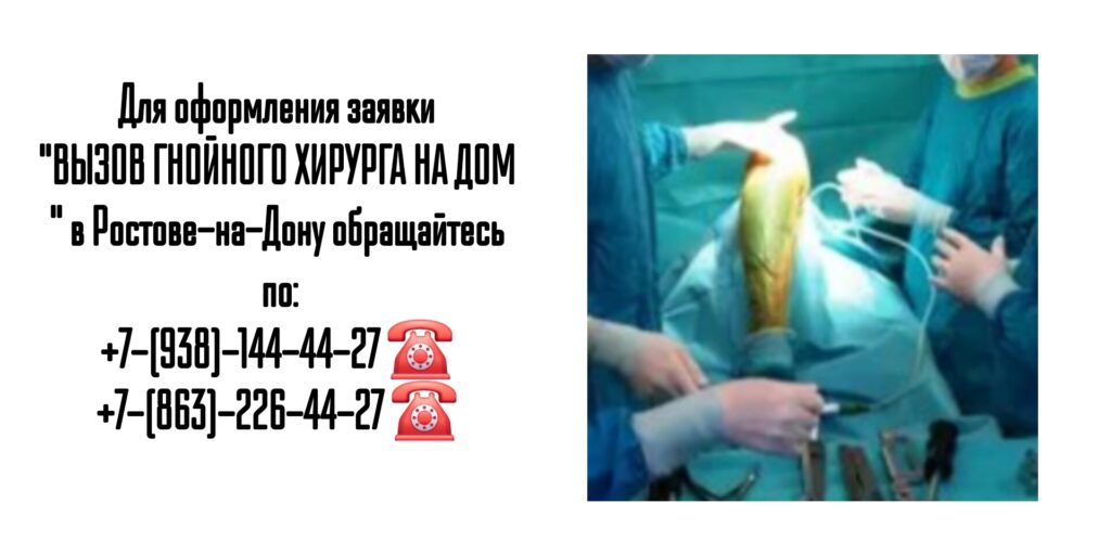 Вызов на дом гнойного хирурга- Ростов-на-Дону 