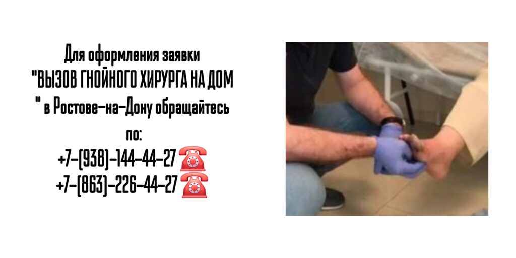 Вызов на дом гнойного хирурга- Ростов-на-Дону 