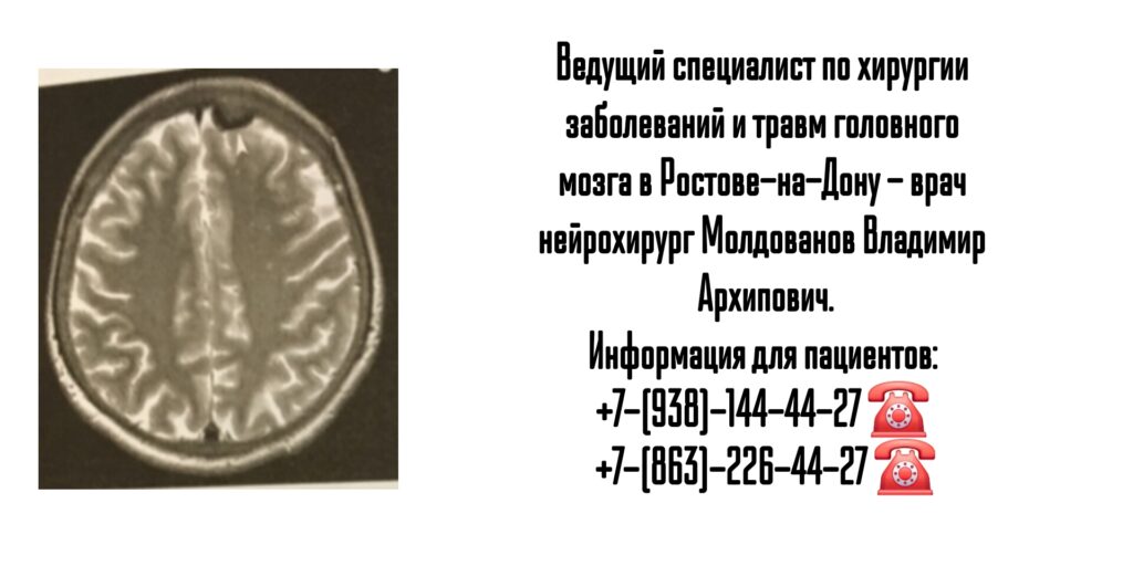 Ростов нейрохирург- Молдованов В.А.