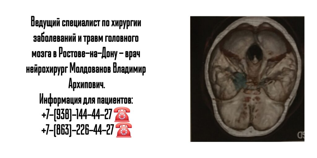 Ростов нейрохирург- Молдованов В.А.