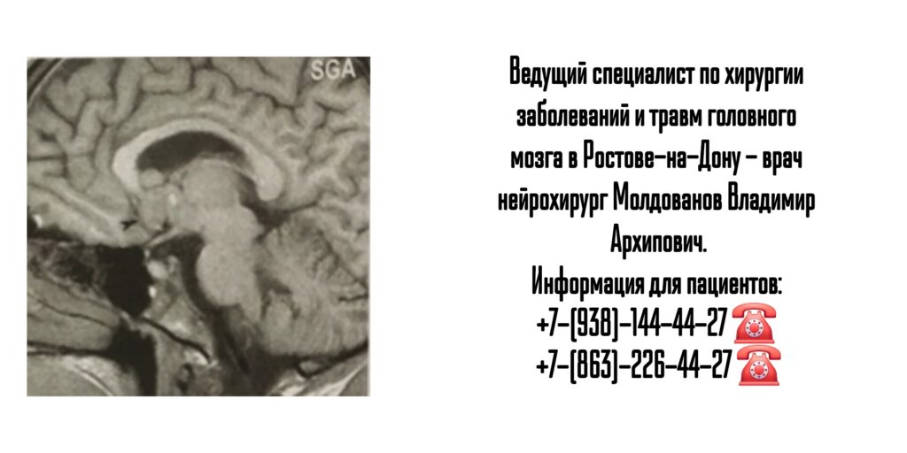 Ростов нейрохирург- Молдованов В.А.