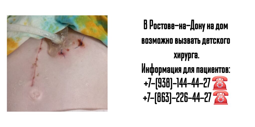 Вызов детского хирурга на дом в Ростове-на-Дону 