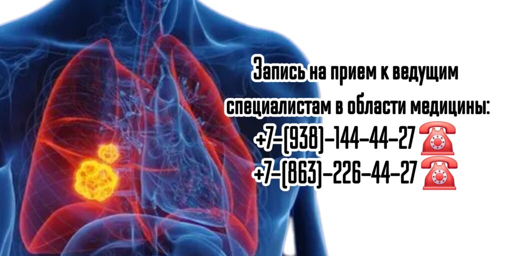 Торакальный хирург - онколог в Ростове-на-Дону- Карапетян Карен Сергеевич 