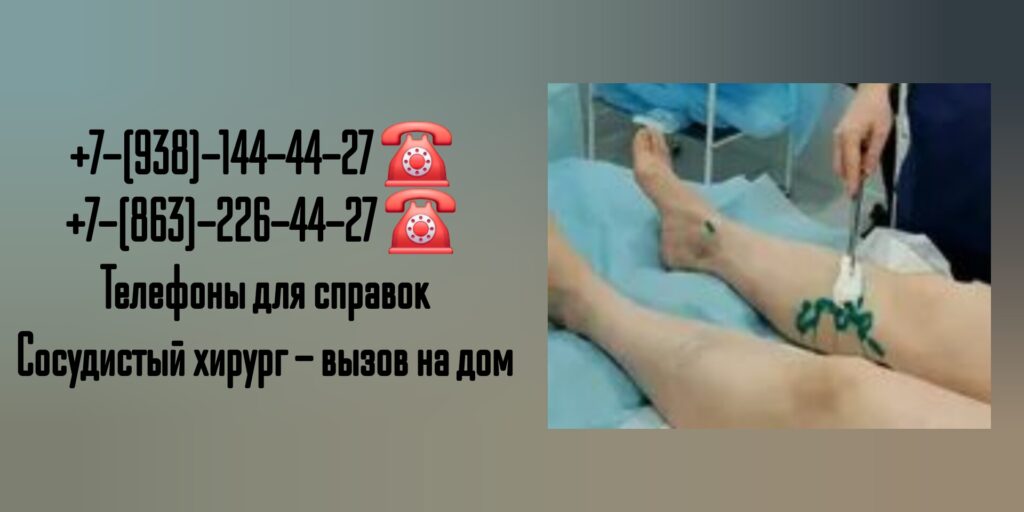 Вызов сосудистого хирурга на дом Ростов-на-Дону
