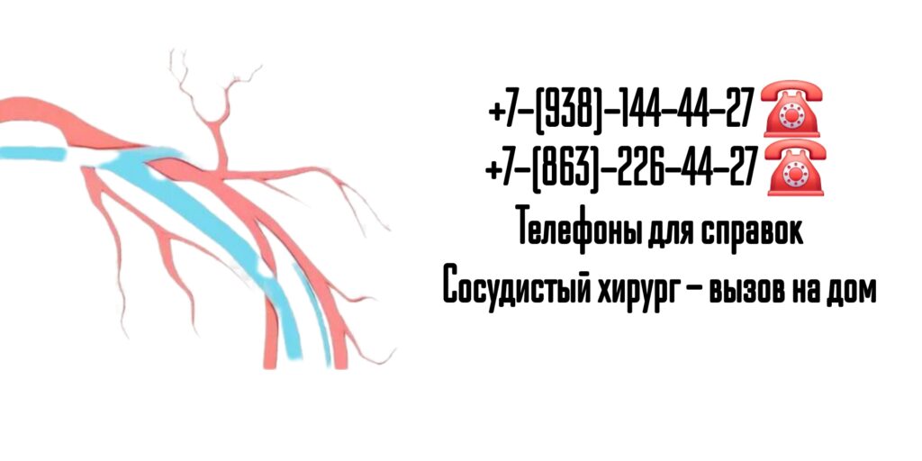 Вызов сосудистого хирурга на дом Ростов-на-Дону
