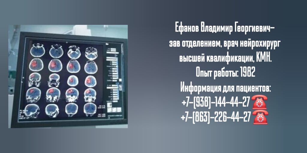 Ефанов Владимир Георгиевич- нейрохирург Ростов 