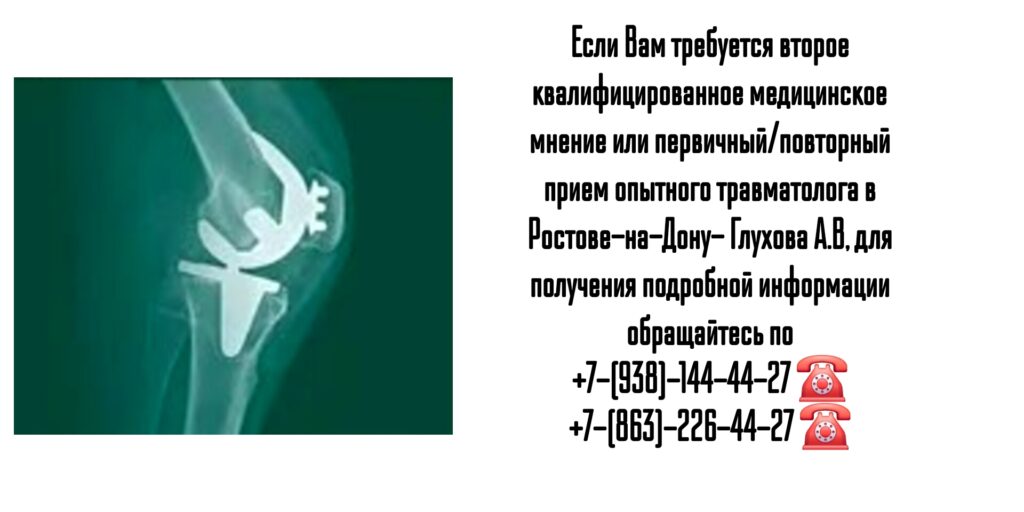 Эндопротезирование коленного и тазобедренных суставов в Ростове-на-Дону - Глухов Алексей Вячеславович 
