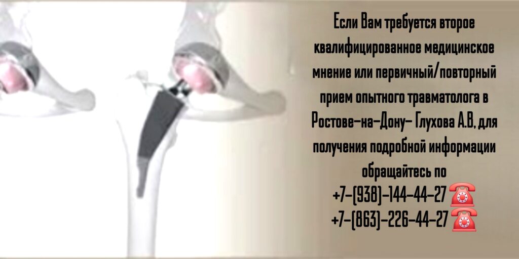 Эндопротезирование коленного и тазобедренных суставов в Ростове-на-Дону - Глухов Алексей Вячеславович 