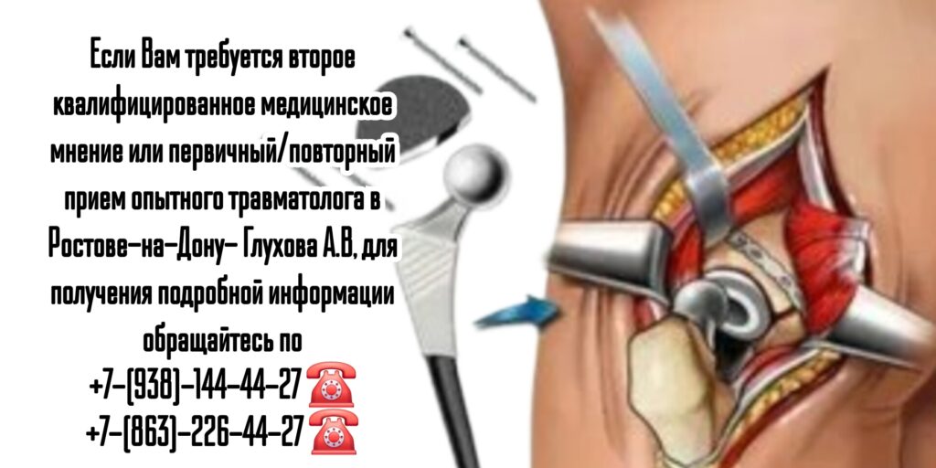 Эндопротезирование коленного и тазобедренных суставов в Ростове-на-Дону - Глухов Алексей Вячеславович 