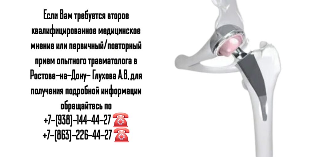Эндопротезирование коленного и тазобедренных суставов в Ростове-на-Дону - Глухов Алексей Вячеславович 