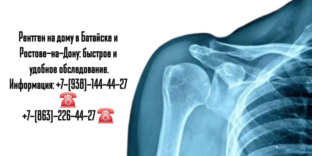 Рентген на дому в Батайске и Ростове-на-Дону: быстрое и удобное обследование.