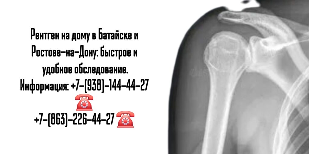 Рентген на дому в Батайске и Ростове-на-Дону: быстрое и удобное обследование.