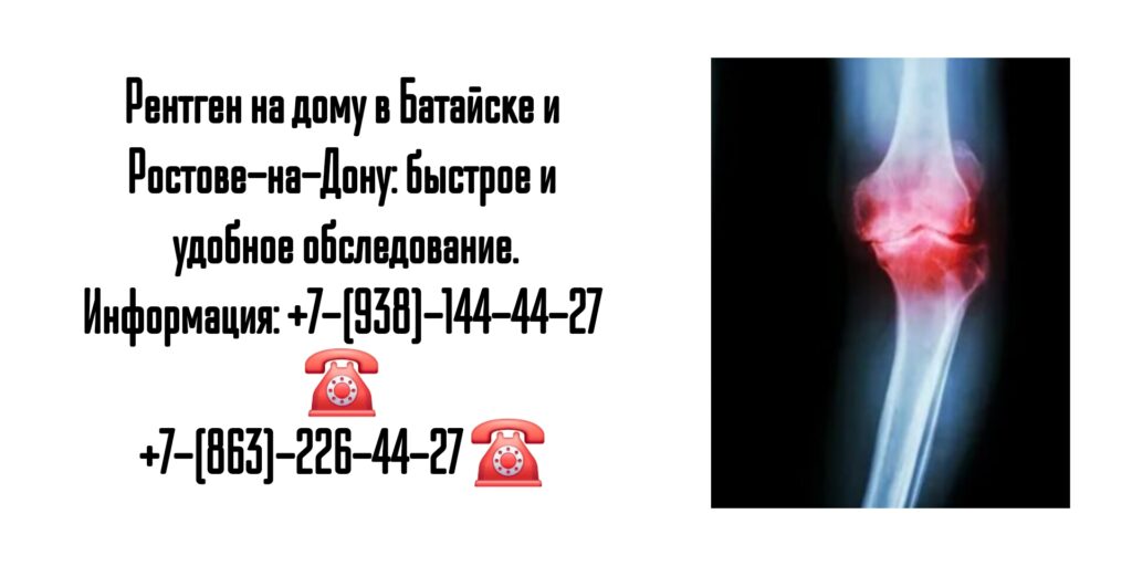 Рентген на дому в Батайске и Ростове-на-Дону: быстрое и удобное обследование.