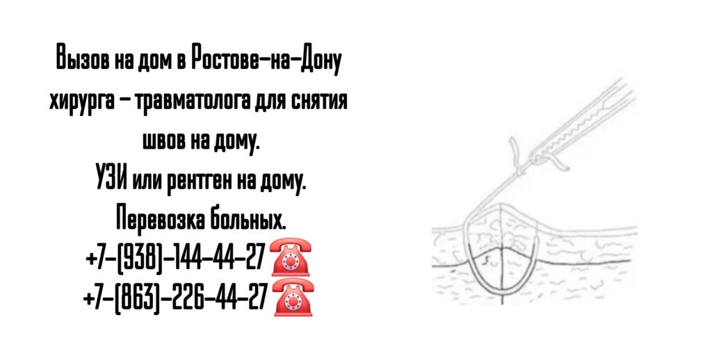 Снятие послеоперационных швов на дому - Ростов-на-Дону