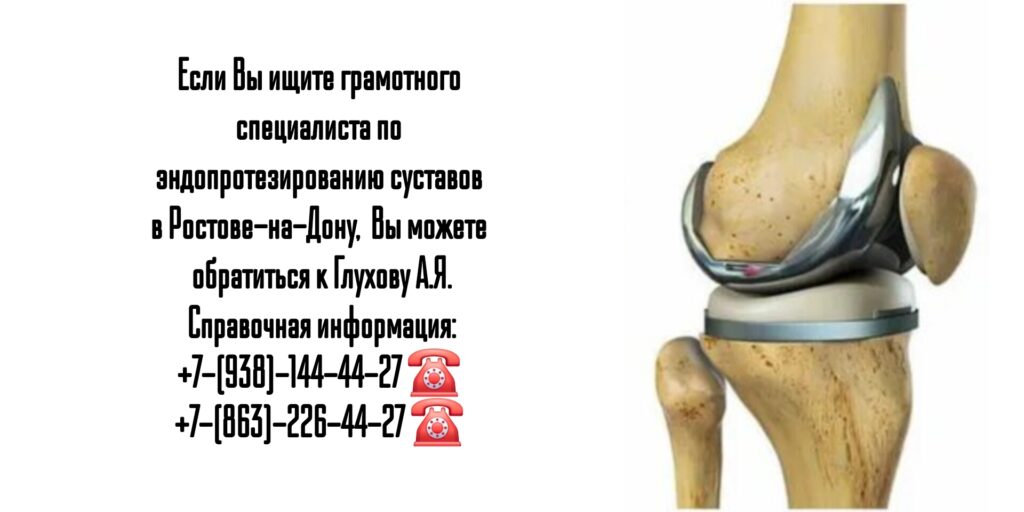 Замена или эндопротезирование суставов в Ростове-на-Дону - Глухов Алексей Вячеславович