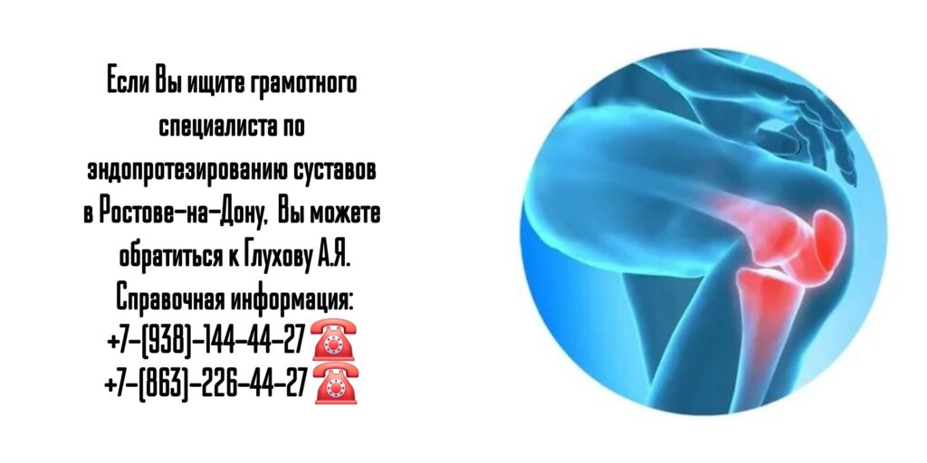 Замена или эндопротезирование суставов в Ростове-на-Дону - Глухов Алексей Вячеславович