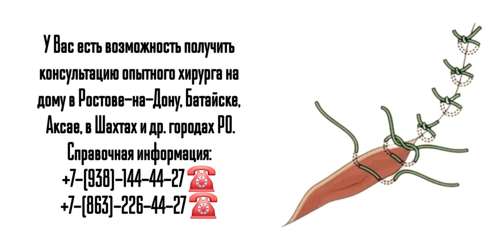 #хирургнадомростов

#вызовврачанадомростов

#снятьшвынадомупослеопеоацииростов

#онкологнадомростов