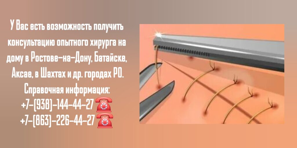 #хирургнадомростов

#вызовврачанадомростов

#снятьшвынадомупослеопеоацииростов

#онкологнадомростов