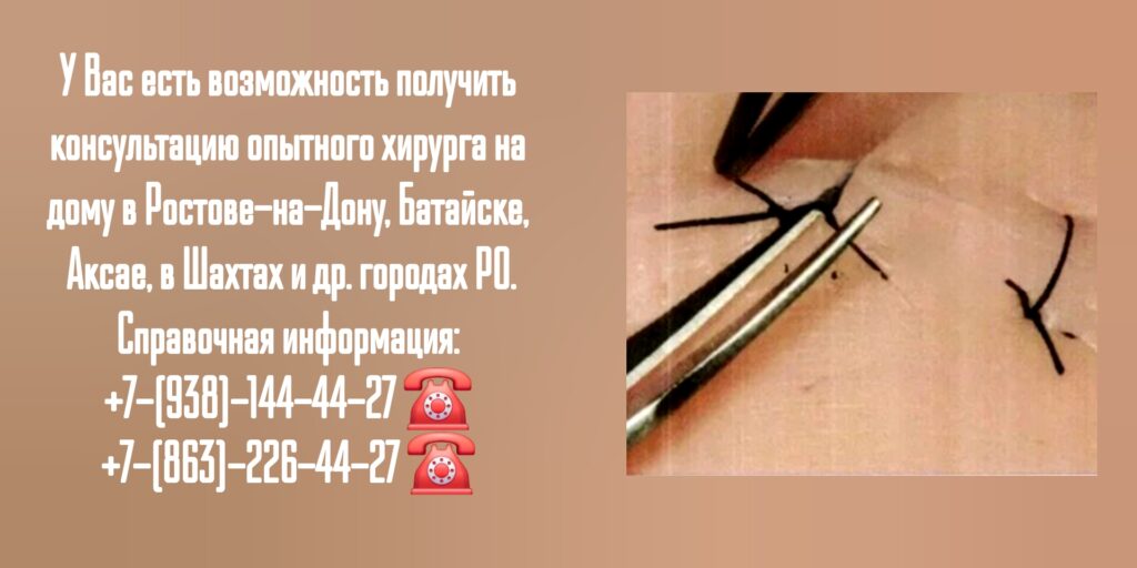 #хирургнадомростов

#вызовврачанадомростов

#снятьшвынадомупослеопеоацииростов

#онкологнадомростов
