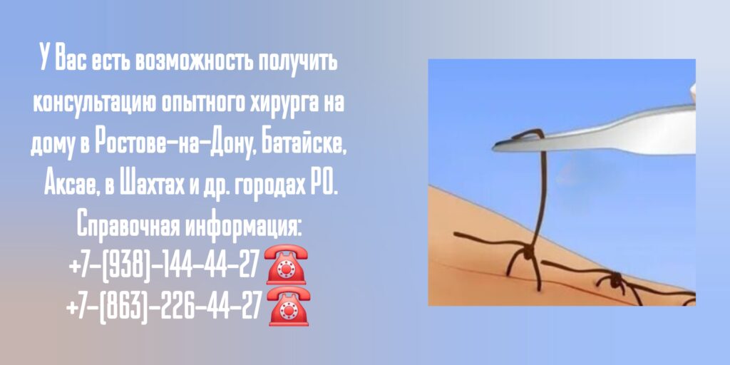 #хирургнадомростов

#вызовврачанадомростов

#снятьшвынадомупослеопеоацииростов

#онкологнадомростов