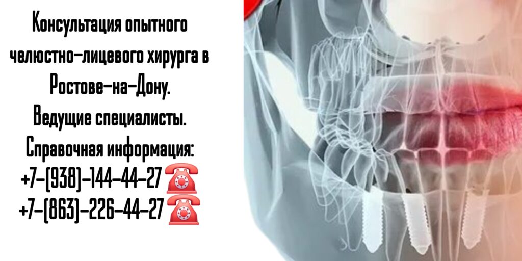 Челюстно-лицевые хирурги Ростова-на-Дону
