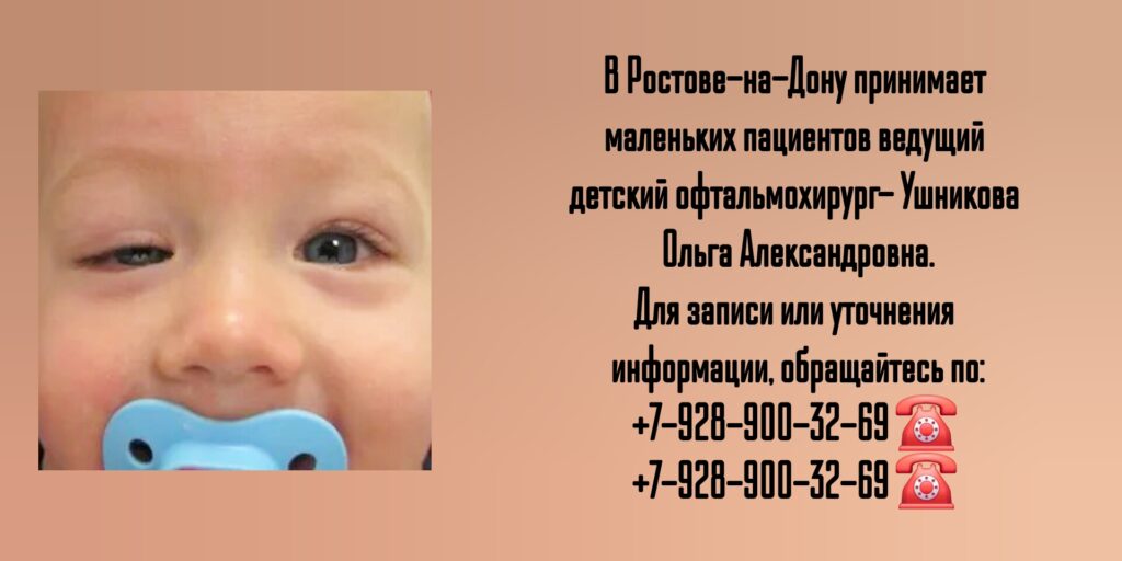 Птоз у детей - детский офтальмохирург в Ростове-на-Дону