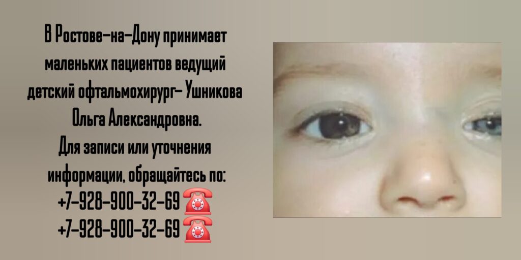 Птоз у детей - детский офтальмохирург в Ростове-на-Дону