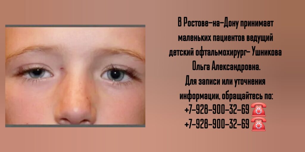 Птоз у детей - детский офтальмохирург в Ростове-на-Дону