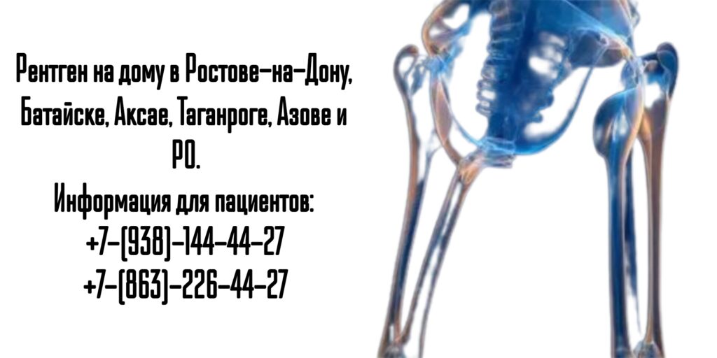 Ростов-на-Дону - Рентген на дому
