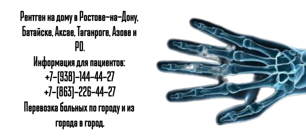 Ростов-на-Дону - Рентген на дому