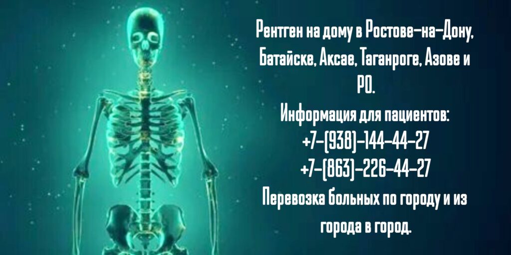 Ростов-на-Дону - Рентген на дому