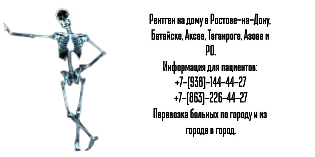 Ростов-на-Дону - Рентген на дому