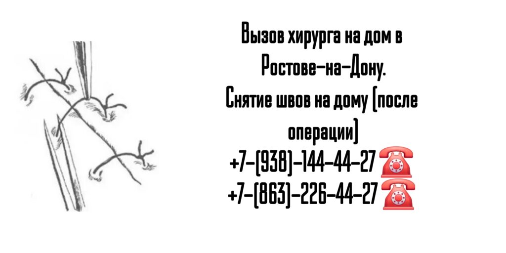 Снять швы на дому Ростов-на-Дону