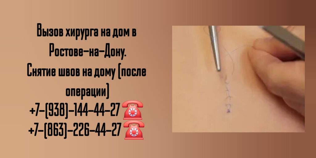 Снять швы на дому Ростов-на-Дону