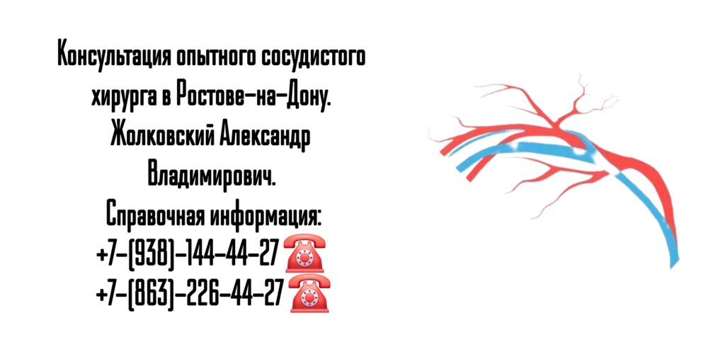 Жолковский Александр Владимирович - ведущий сосудистый хирург