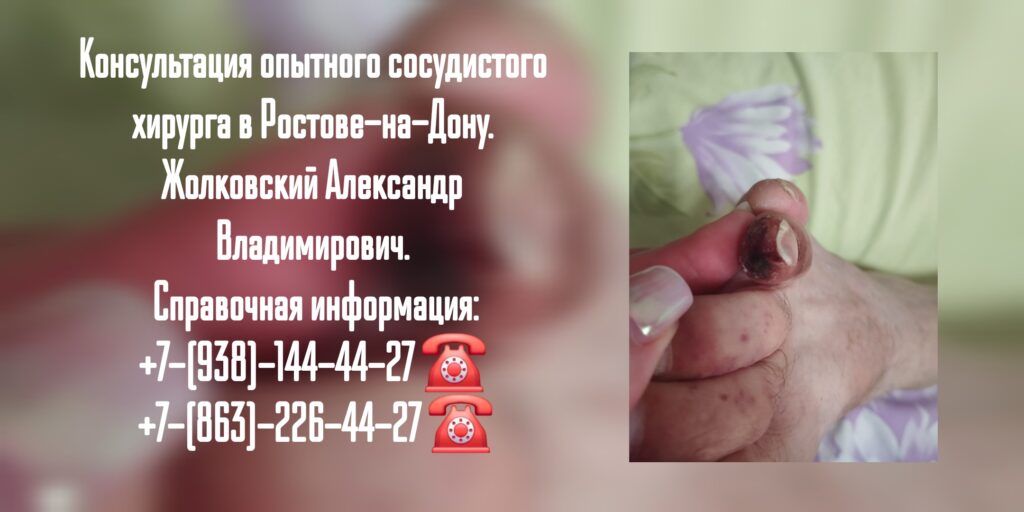 Жолковский Александр Владимирович - ведущий сосудистый хирург