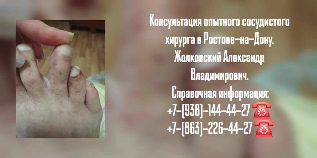 Жолковский Александр Владимирович - ведущий сосудистый хирург