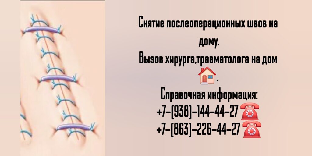 Снятие послеоперационных швов на дому в г. Шахты
